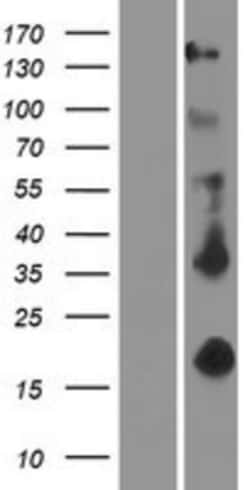 Novus Biologicals&trade;&nbsp;EDA/Ectodysplasin Overexpression Lysate