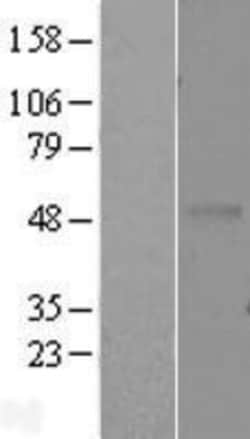 Novus Biologicals&trade;&nbsp;EDAR Overexpression Lysate