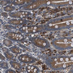 EDARADD Antibody, Novus Biologicals 25 &mu;L; Unlabeled:Antibodies, Polyclonal
