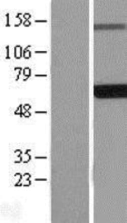 Novus Biologicals&trade;&nbsp;EDC3 Overexpression Lysate