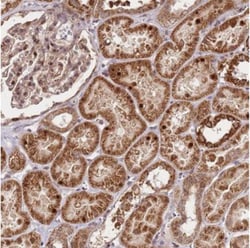 EDC3 Antibody, Novus Biologicals:Antibodies:Primary Antibodies