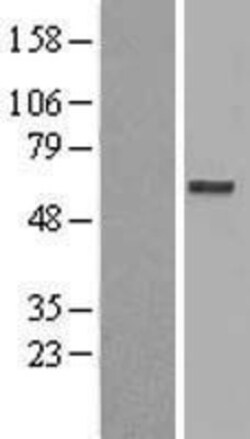 Novus Biologicals&trade;&nbsp;EDEM2 Overexpression Lysate