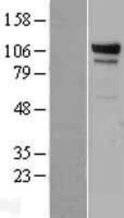 Novus Biologicals&trade;&nbsp;EDEM3 Overexpression Lysate