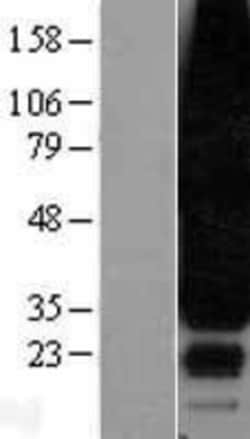 Novus Biologicals&trade;&nbsp;S1P3/EDG-3 Overexpression Lysate