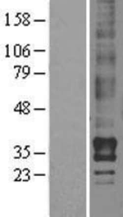 Novus Biologicals&trade;&nbsp;LPAR2/LPA2/EDG-4 Overexpression Lysate