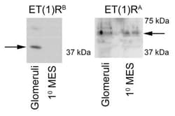 EDNRA/Endothelin R Type A Antibody, Novus Biologicals:Antibodies:Primary
