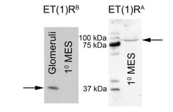 EDNRA/Endothelin R Type A Antibody, Novus Biologicals:Antibodies:Primary