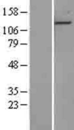 Novus Biologicals&trade;&nbsp;EDR1/PHC1 Overexpression Lysate