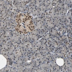 EDR1/PHC1 Antibody, Novus Biologicals:Antibodies:Primary Antibodies