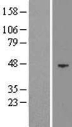 Novus Biologicals&trade;&nbsp;EED Overexpression Lysate
