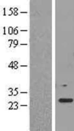 Novus Biologicals&trade;&nbsp;EEF1B2 Overexpression Lysate