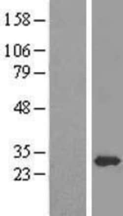 Novus Biologicals™ EEF1B2 Overexpression Lysate
