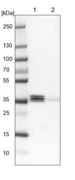 EEF1D Antibody, Novus Biologicals 0.1mL; Unlabeled:Antibodies, Polyclonal