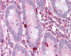 eEF-2 Antibody, Novus Biologicals 0.05mg; Unlabeled:Antibodies, Polyclonal