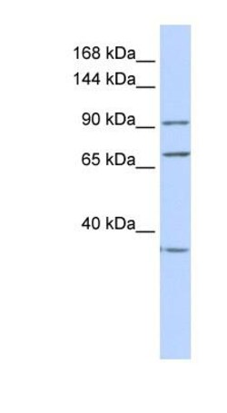 eEF-2 Antibody, Novus Biologicals 0.05mg; Unlabeled:Antibodies, Polyclonal