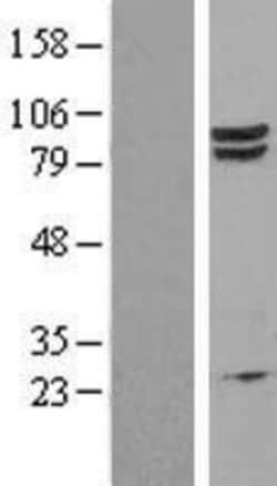 Novus Biologicals&trade;&nbsp;EEF2K Overexpression Lysate