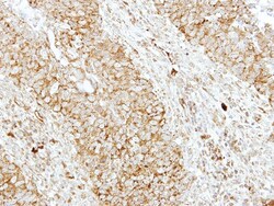 EEN Antibody, Novus Biologicals 0.1mg; Unlabeled:Antibodies, Polyclonal