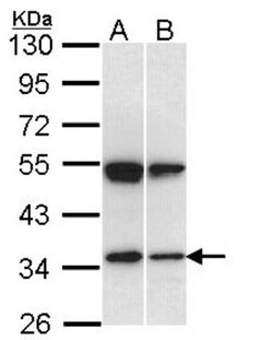 EEN Antibody, Novus Biologicals 0.1mg; Unlabeled:Antibodies, Polyclonal