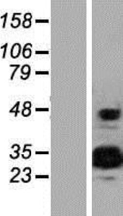 Novus Biologicals&trade;&nbsp;EFCAB2 Overexpression Lysate