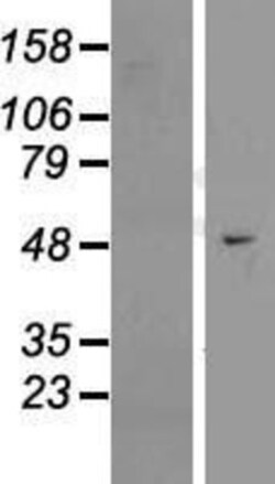 Novus Biologicals&trade;&nbsp;EFCAB3 Overexpression Lysate