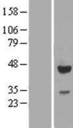 Novus Biologicals&trade;&nbsp;EFCAB4B Overexpression Lysate