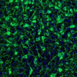 EFCBP2 Antibody, Novus Biologicals 0.1mL; Unlabeled:Antibodies, Polyclonal