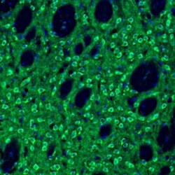 EFCBP2 Antibody, Novus Biologicals 0.1mL; Unlabeled:Antibodies, Polyclonal