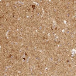 EFCBP2 Antibody, Novus Biologicals 0.1mL; Unlabeled:Antibodies, Polyclonal