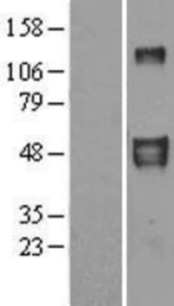 Novus Biologicals™ EFEMP2 Overexpression Lysate