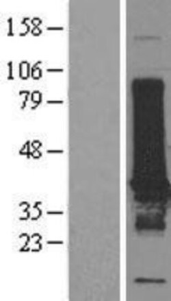 Novus Biologicals&trade;&nbsp;EFHD1 Overexpression Lysate