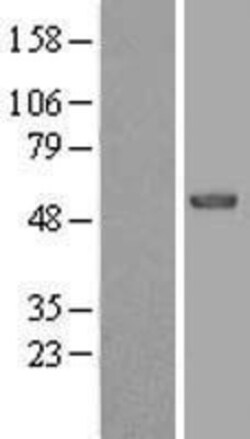 Novus Biologicals&trade;&nbsp;EFS Overexpression Lysate