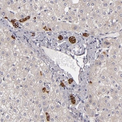 EFS Antibody, Novus Biologicals:Antibodies:Primary Antibodies