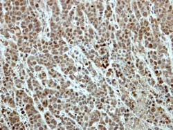 EFTUD2 Antibody, Novus Biologicals 0.1 mL | Buy Online | Novus Biologicals | Fisher Scientific