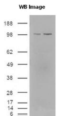 Eg5 Antibody, Novus Biologicals 0.1mL; Unlabeled:Antibodies, Polyclonal