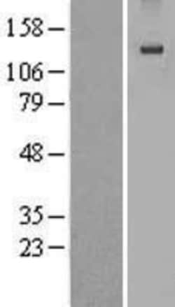 Novus Biologicals&trade;&nbsp;EGF Overexpression Lysate