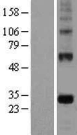 Novus Biologicals&trade;&nbsp;VE-Statin/EGFL7 Overexpression Lysate