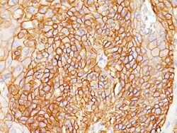 EGFR Antibody (GFR450), Novus Biologicals 0.1mg; Unlabeled:Antibodies,