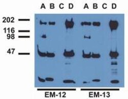 EGFR, p Tyr1173 Antibody (EM-13) - BSA Free, Novus Biologicals 0.1mg; Unlabeled:Antibodies,
