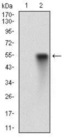 EGFR Antibody (5E10D3) - BSA Free, Novus Biologicals 0.1mL; Unlabeled:Antibodies,