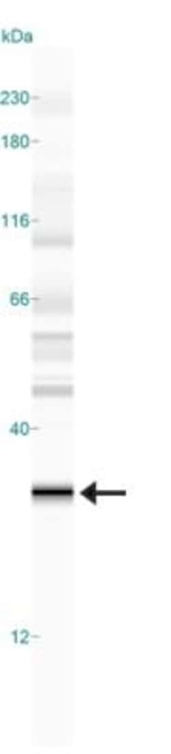 EGLN3/PHD3 Antibody (EG188e/d5) - BSA Free, Novus Biologicals 0.2mL; Unlabeled:Antibodies,