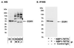 EGR1 Antibody, Novus Biologicals 0.1mg; Unlabeled:Antibodies, Polyclonal