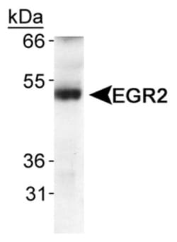 EGR2 Antibody - BSA Free, Novus Biologicals:Antibodies:Primary Antibodies