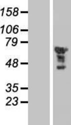 Novus Biologicals&trade;&nbsp;EGR2 Overexpression Lysate