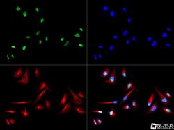 EGR2 Antibody - BSA Free, Novus Biologicals:Antibodies:Primary Antibodies