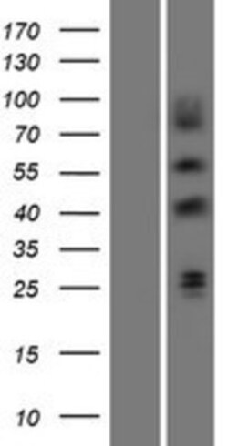 Novus Biologicals&trade;&nbsp;EGR3 Overexpression Lysate
