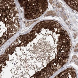 EHBP1 Antibody, Novus Biologicals 25 &mu;L, Unlabeled:Antibodies, Polyclonal