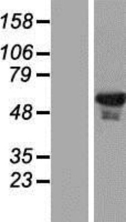 Novus Biologicals&trade;&nbsp;EHD1 Overexpression Lysate