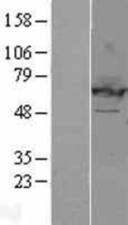 Novus Biologicals&trade;&nbsp;EHD2 Overexpression Lysate