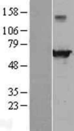 Novus Biologicals&trade;&nbsp;EHD4 Overexpression Lysate