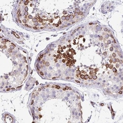 EHD4 Antibody, Novus Biologicals:Antibodies:Primary Antibodies
